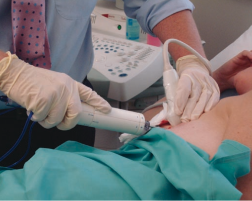 Sinh thiết vú – Quy trình, các phương pháp và tại sao “sinh thiết tối thiểu xâm lấn” rất quan trọng?