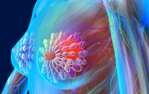 Bao lâu sau hóa trị tóc mọc lại? Giải đáp cho bệnh nhân ung thư vú