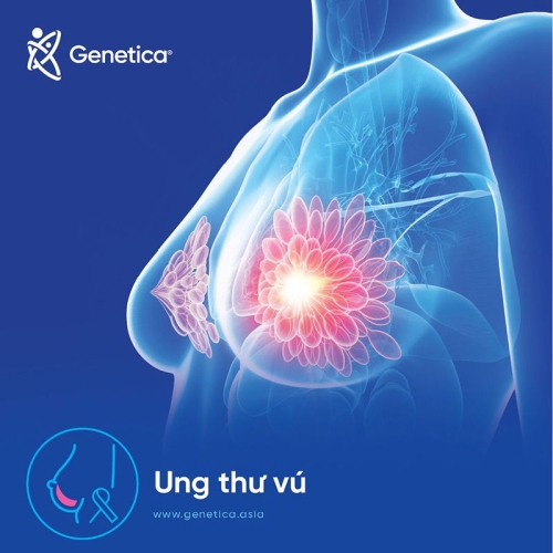 Cyclophosphamide trong điều trị ung thư vú – Cơ chế, hiệu quả và tác dụng phụ