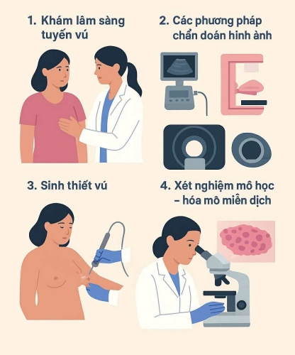 GIẢI MÃ QUY TRÌNH CHẨN ĐOÁN UNG THƯ VÚ: TỪ KHÁM BAN ĐẦU ĐẾN SINH THIẾT.